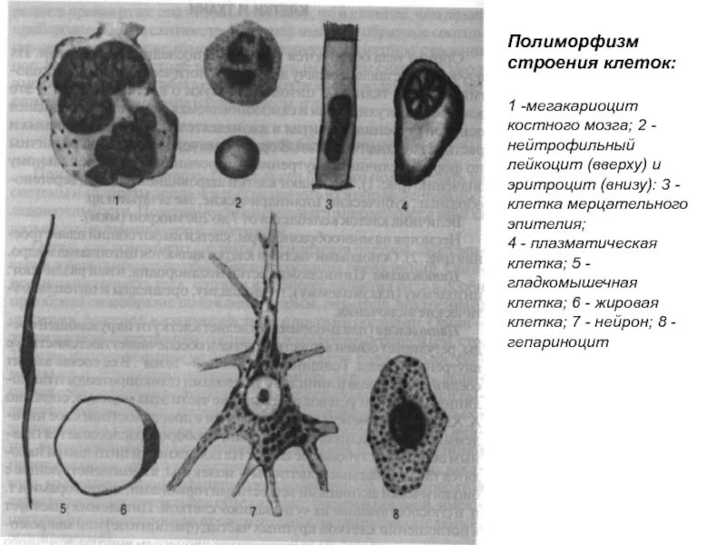 Полиморфизм опухоли это в патологии. Полиморфизм строения клеток. Полиморфизм строения злокачественной опухоли. Эндометриоидная аденокарцинома g1. Многоядерный мерцательный эпителий кишечника беззубки.
