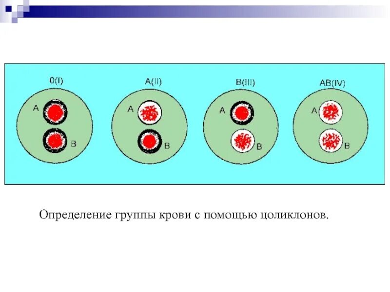 Цоликлоны для определения групп крови АВО И резус принадлежности. Резус фактора цоликлонами. Определение группы крови цоликлонами таблица. Группа крови Цоликлоны. Таблица цоликлонов