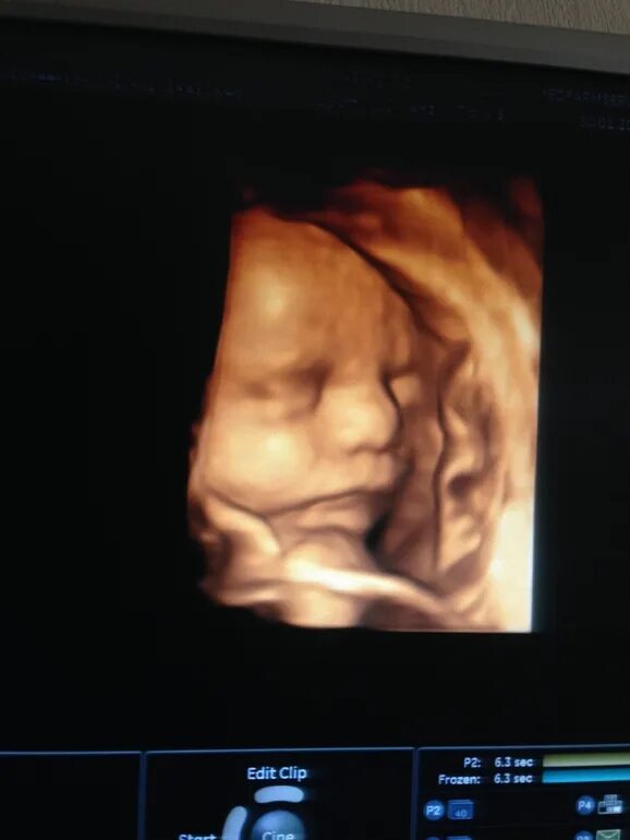 4д узи при беременности. Скрининг 4д. Скрининг 4д. 3д узи скрининг обнинск. Скрининг 4д.