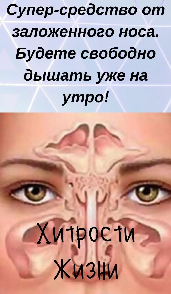 Санорин спрей 0. Снять заложенность носа без лекарств быстро. Средство от заложенности носа отзывы. Средство от заложенности носа отзывы. Мазь в нос от насморка и заложенности носа.
