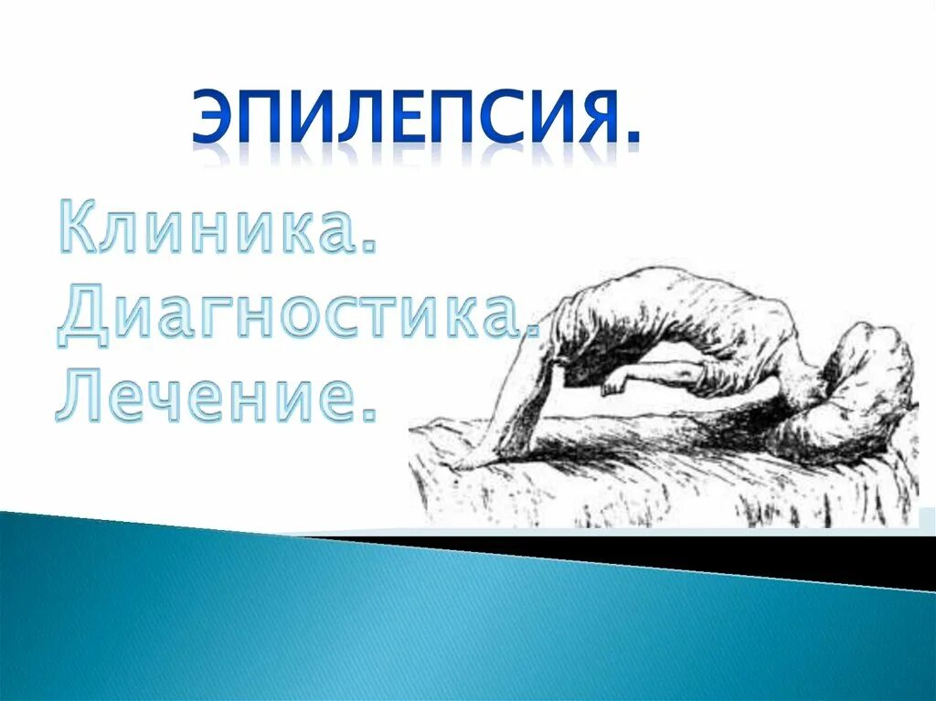 Эпилепсия клиника. Эпилепсия клиника диагностика лечение. Символ эпилепсии.