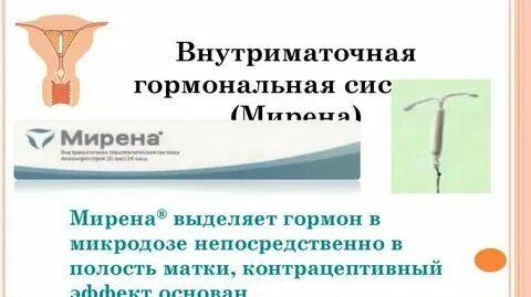 Спираль ставят после кесарева