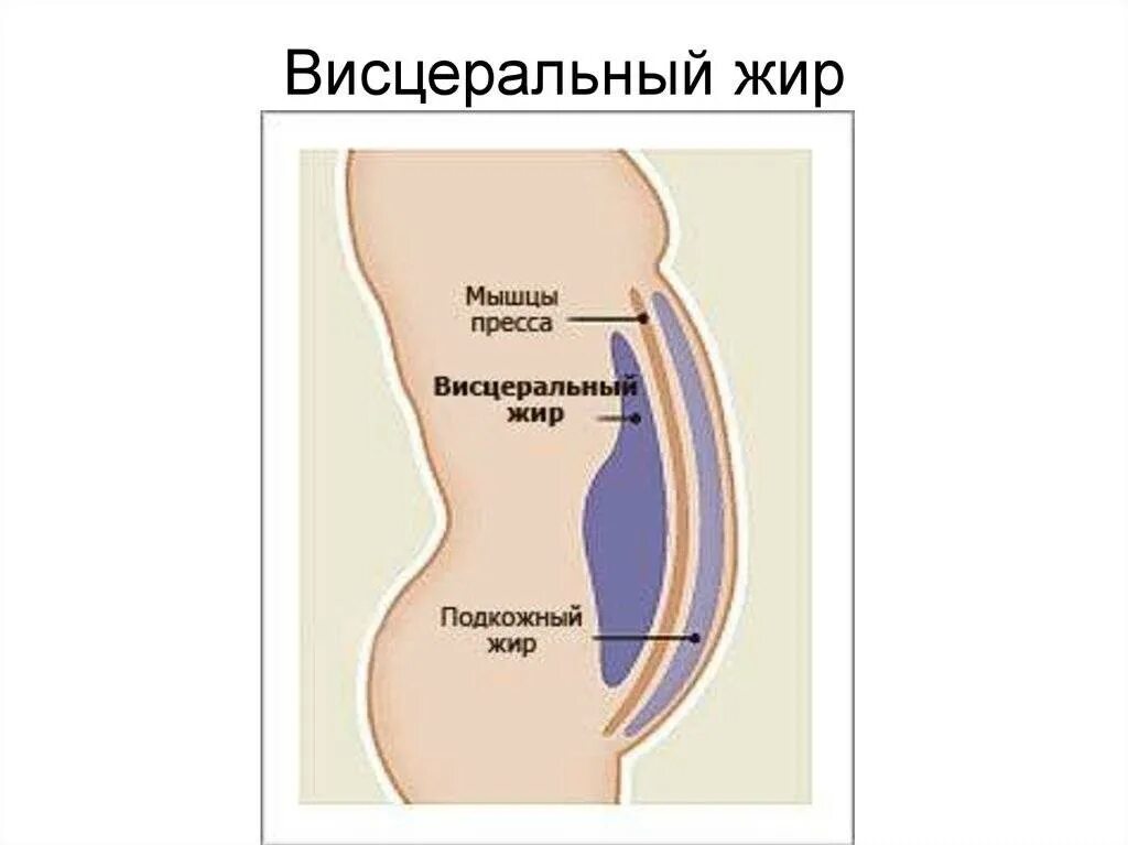Откуда жир. Абдоминальный и висцеральный жир. подкожный и висцеральный жир.