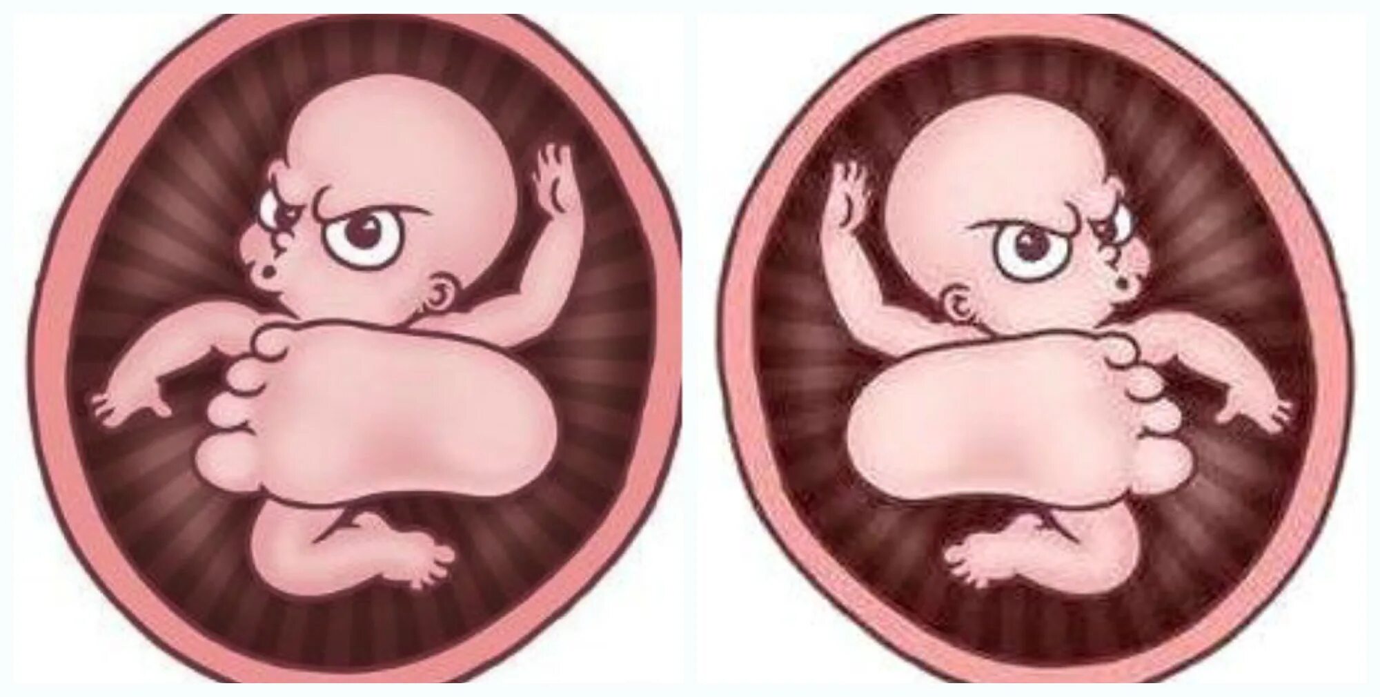 2 беременность шевеления. Многоплодная беременность Близнецы в утробе. Малыш в животике.