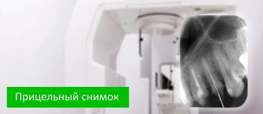 Видео как делать рентген. Прицельный снимок в стоматологии. как сделать прицельный снимок зуба. прицельный снимок зуба как правильно сделать. алгоритм прицельных снимков зубов.