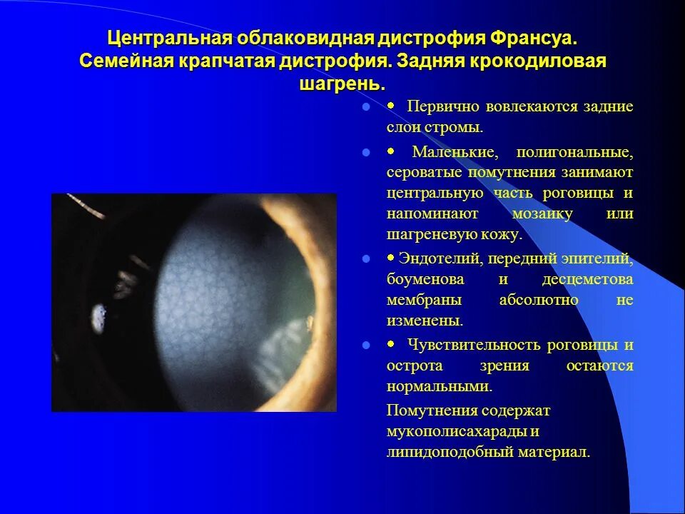 Дистрофия передней базальной мембраны когана. Дистрофия роговицы базальной мембраны. Дистрофия когана. Дистрофия когана. Дистрофия когана.