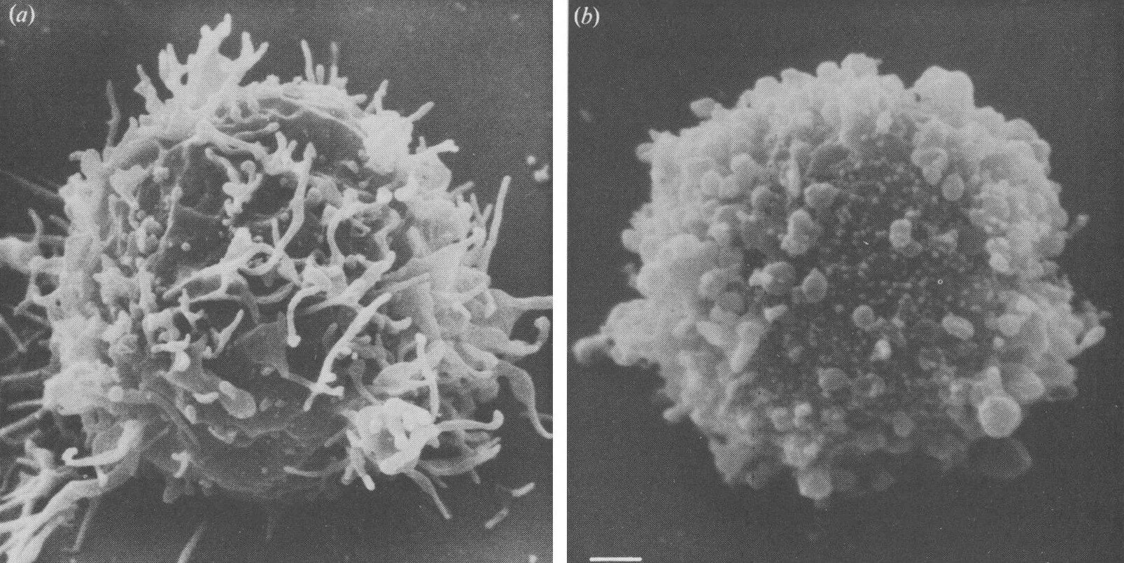 Вирус иммунодефицита под микроскопом. ВИЧ электронная микроскопия. Вирус СПИДА под микроскопом. Вирус ВИЧ пол миркоскоп.
