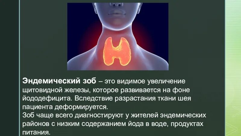 Зоб еда. Эндемический зоб презентация. эндемический зоб картинки. факторы риска эндемического зоба. эндемический зоб клинические рекомендации.