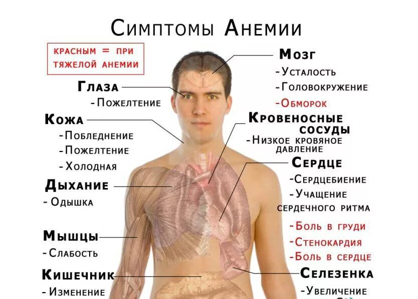 Признаки нехватки железа. Недостаток железа симптомы. Симптомы малокровия у подростков.