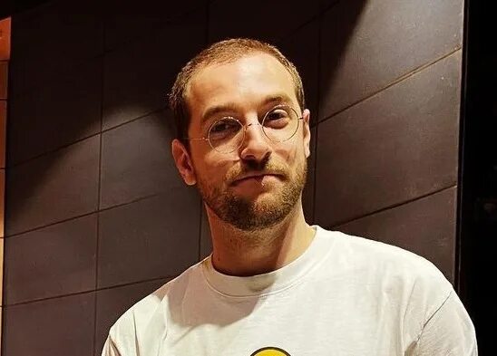 Андрей бебуришвили до и после пересадки волос Андрей Бебуришвили рассказал о трудностях нахождения рядом с больной раком мамой