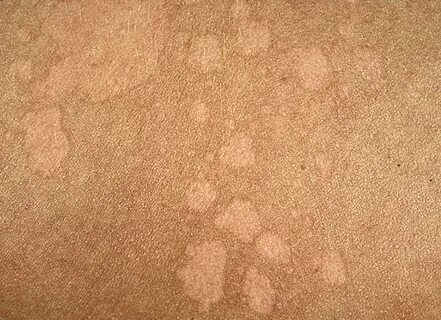 Қан кету жыныстық қатынас кезінде пайда болады