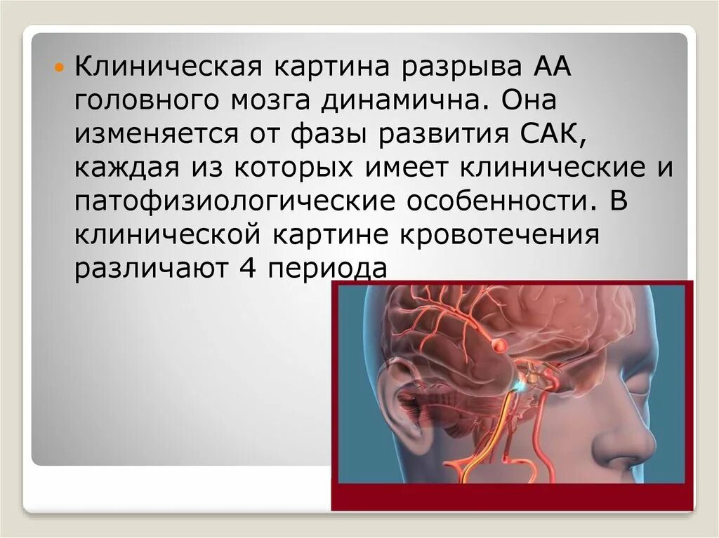 Аневризма головного мозга. Разрыв сосуда в головном мозге. Аневризма сосудов головного мозга. Разрыв аневризмы головного мозга.