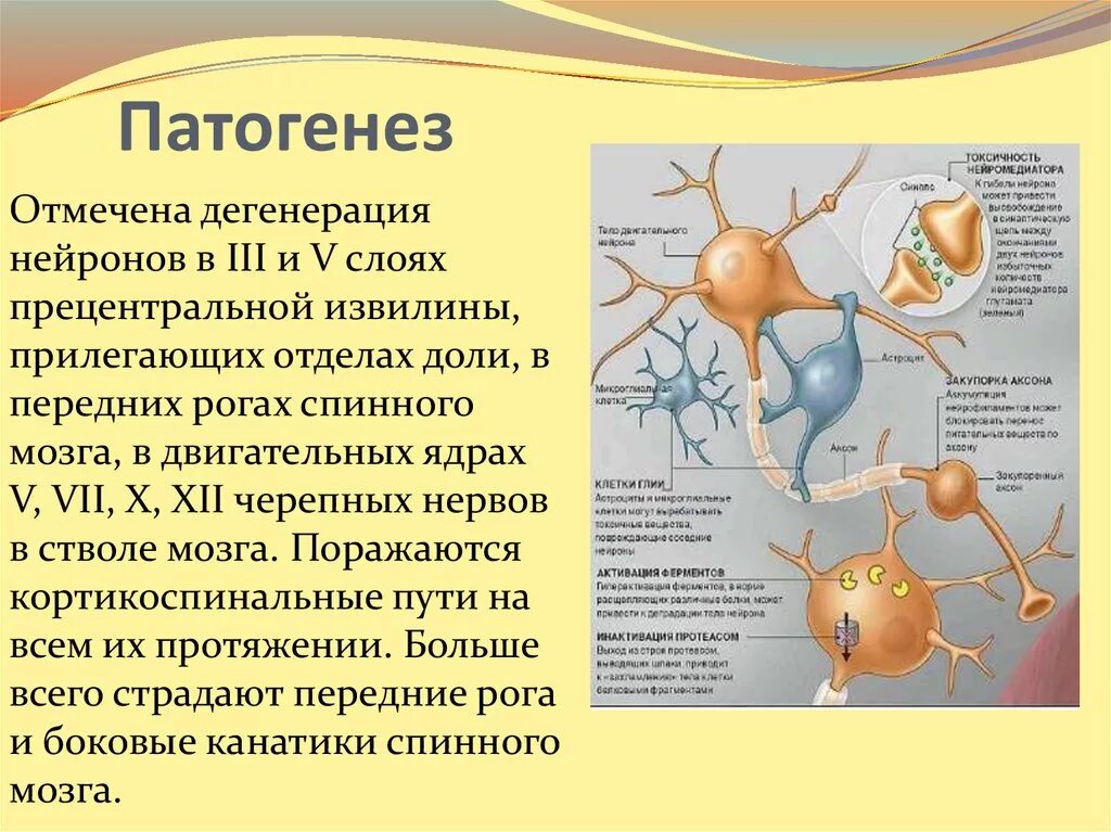 Дегенерация головного. Боковой амиотрофический склероз патогенез. Боковой амиотрофический склероз неврология патогенез. Патогенез бокового амиотрофического. Боковой амиотрофический склероз патогенез клиника.