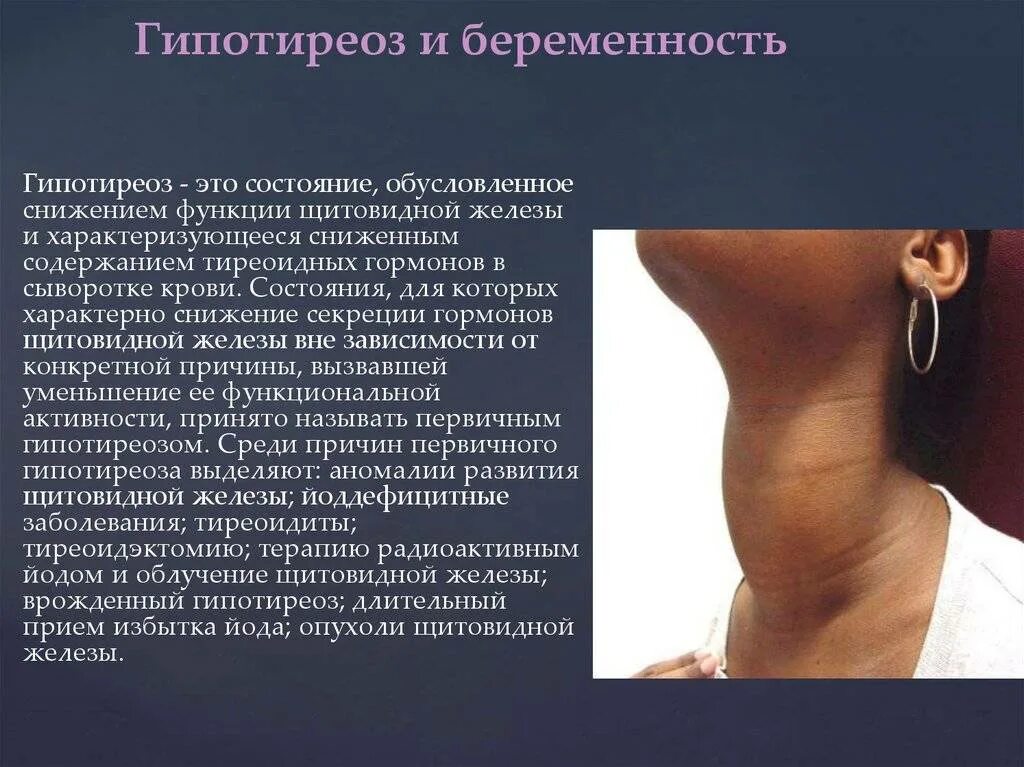 Типы гипотиреоза. Патологии щитовидной железы гипофункция. Щитовидка тиреотоксикоз. Сниженная функция щитовидной железы. Заболевания при гипофункции щитовидной железы.