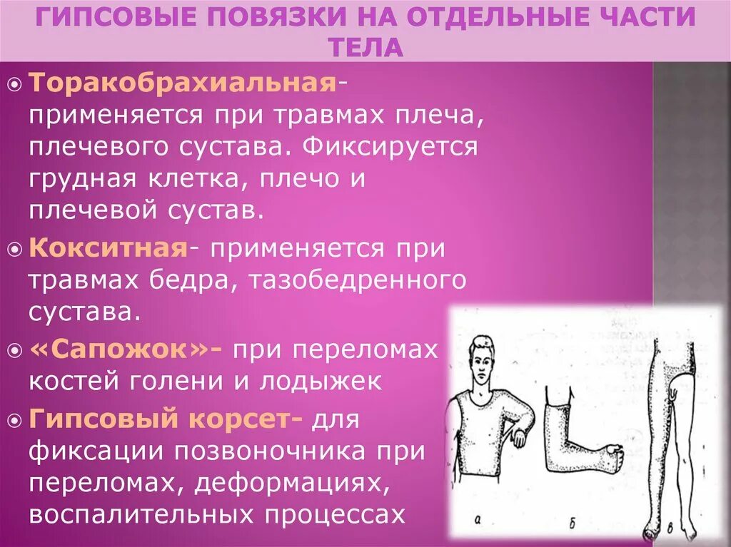 При открытом переломе накладывают. Разновидности гипсовых повязок. Лонгетная гипсовая повязка. Подкладочная гипсовая повязка. Гипсовые повязки различных типов.