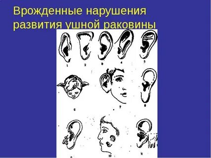 Врожденные нарушения развития