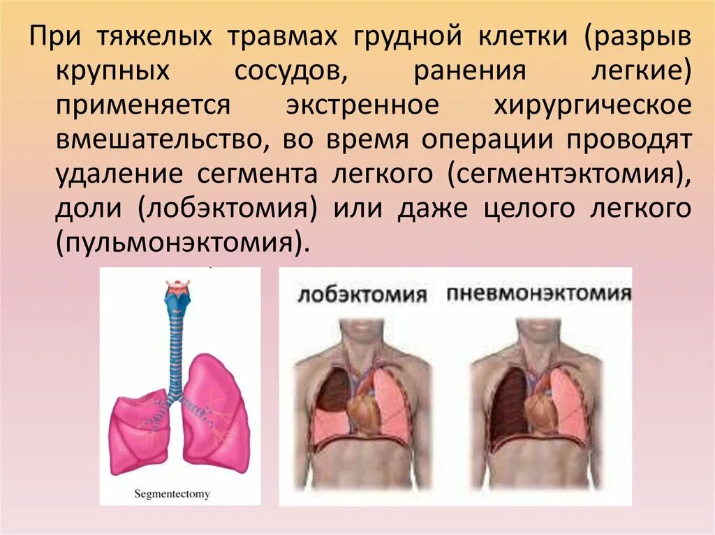 Операция легких реабилитация. ПП при травме грудной клетки. Последовательность при травме грудной клетки. Операции на легких презентация.