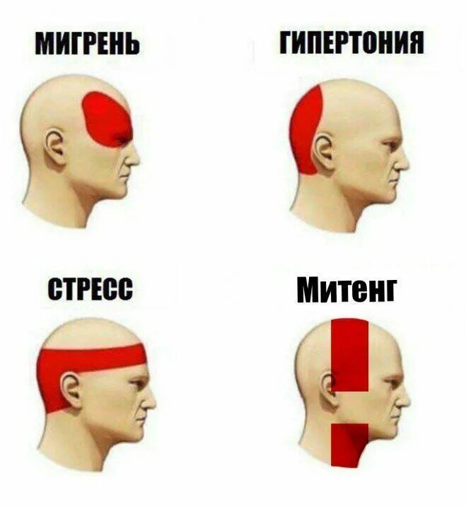 Неделю болит голова что это может быть. Типы головной боли. болит голова. головная боль мем. голова болит мемы.