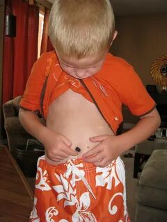 Belly boy