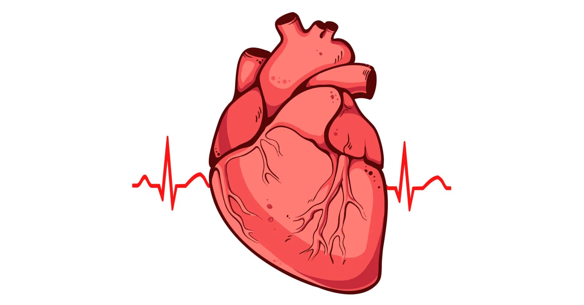 Мс сердца. Инфаркт миокарда сердце. Инфаркт миокарда рисунок.