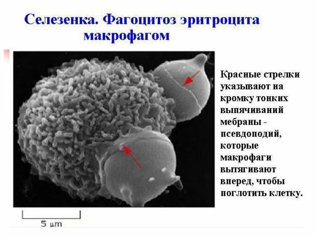 Фагоцитоз гистология. Селезеночные макрофаги. Фагоцитоз эритроцитов.