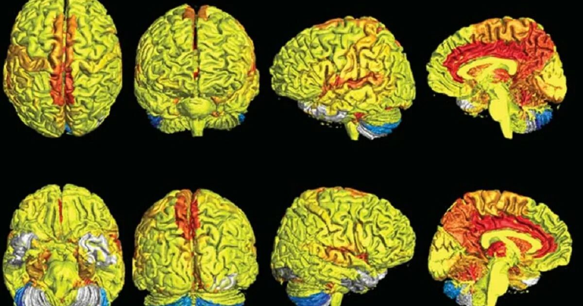 Brain old. Полушария мужчины и женщины. Сравнение мужской и женский мозг анатомия. Размер мужского и женского мозга. Женский мозг.