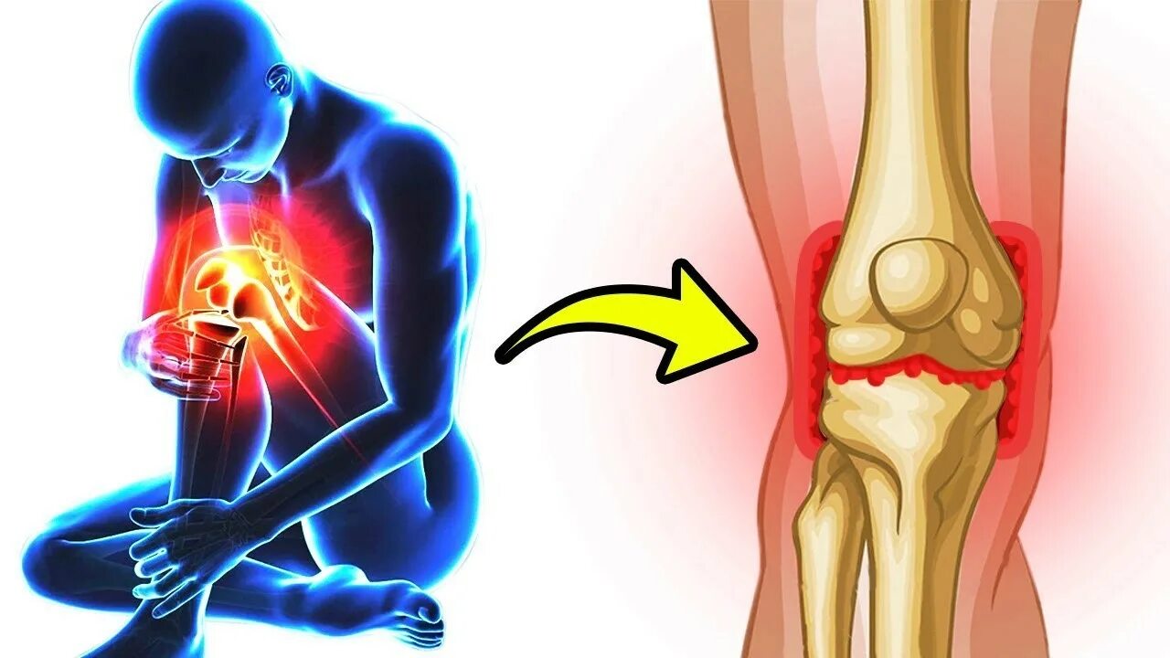 Почему человек хрустит. Боль в суставах. Здоровые суставы.