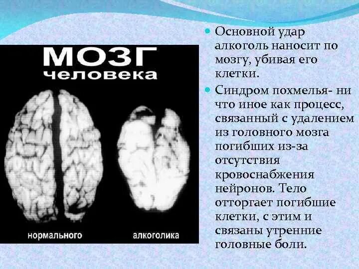 Мозг можно спасти спустя несколько дней. Алкоголь разрушает клетки головного мозга.