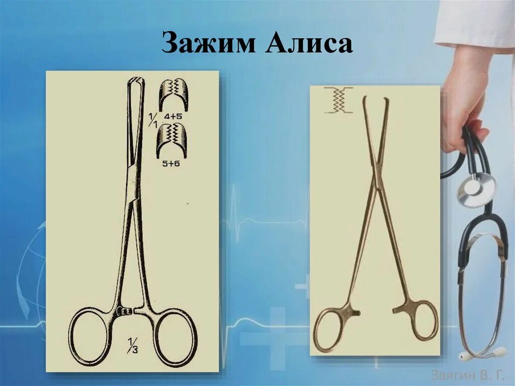 Зажим алиса хирургический фото Зажим Allis 200 мм (Зажим Алиса для захватывания кишечной стенки, 200 мм) Sammar