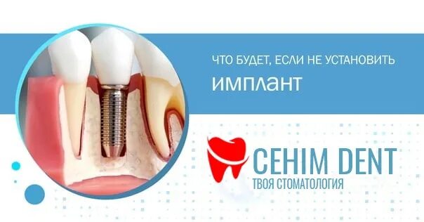 Удалить зуб в ульяновске. Удалить зуб круглосуточно. альфа дент стоматологический материал.