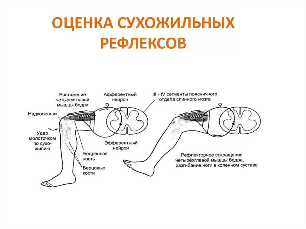 Исследование периостальных рефлексов. Сухожильные рефлексы неврология повышены. Снижение глубоких сухожильных рефлексов. Схемы надкостничных рефлексов. Проверка рефлексов