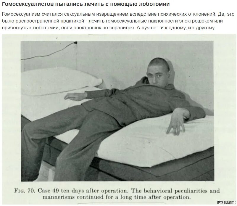 Лоботомия в домашних условиях. Пикабу