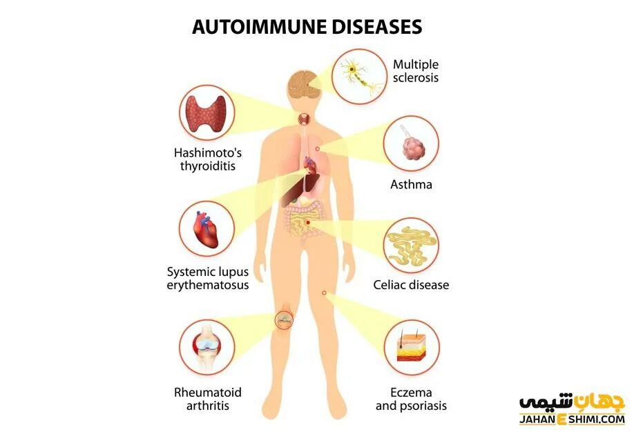 Autoimmune diseases causes. Autoimmune diseases causes. Аунотомные заболевания. Болезни иммунной системы. Autoimmune disease.