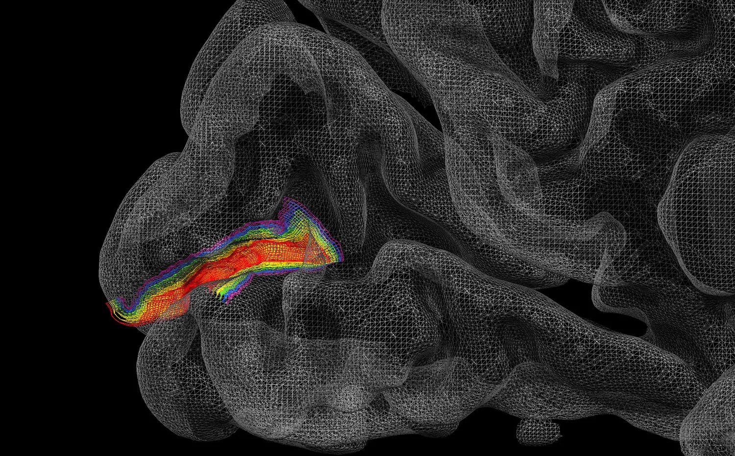 Brain imaging. Визуализация мозга. Интраоперационная тепловизионная визуализация мозга.