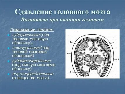 Мозговой г е