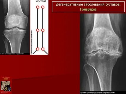Костно суставная система у детей