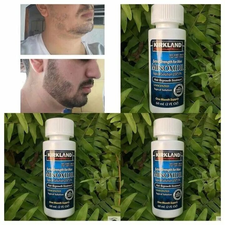 Миноксидил цена отзывы. Миноксидил 5 для бороды. Kirkland Signature Minoxidil. Миноксидил 5 % East Moon. Миноксидил Киркланд для бороды.