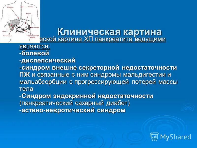 Клинические синдромы при панкреатите. Клиническая картина при панкреатите. Чем характеризуется хроническая