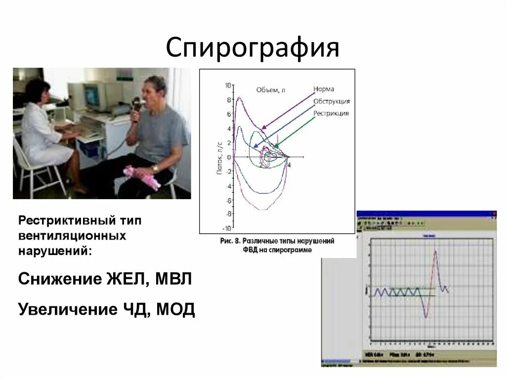 Фвд что это за обследование. Спирография методы исследования. Спирография методика исследования. Спирограмма методика проведения. Мод норма спирометрия.