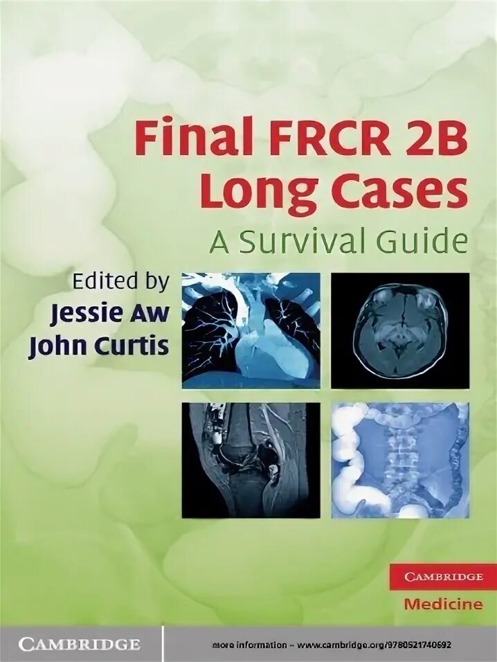 To be no longer the case. Sbas for the final frcr 2a.