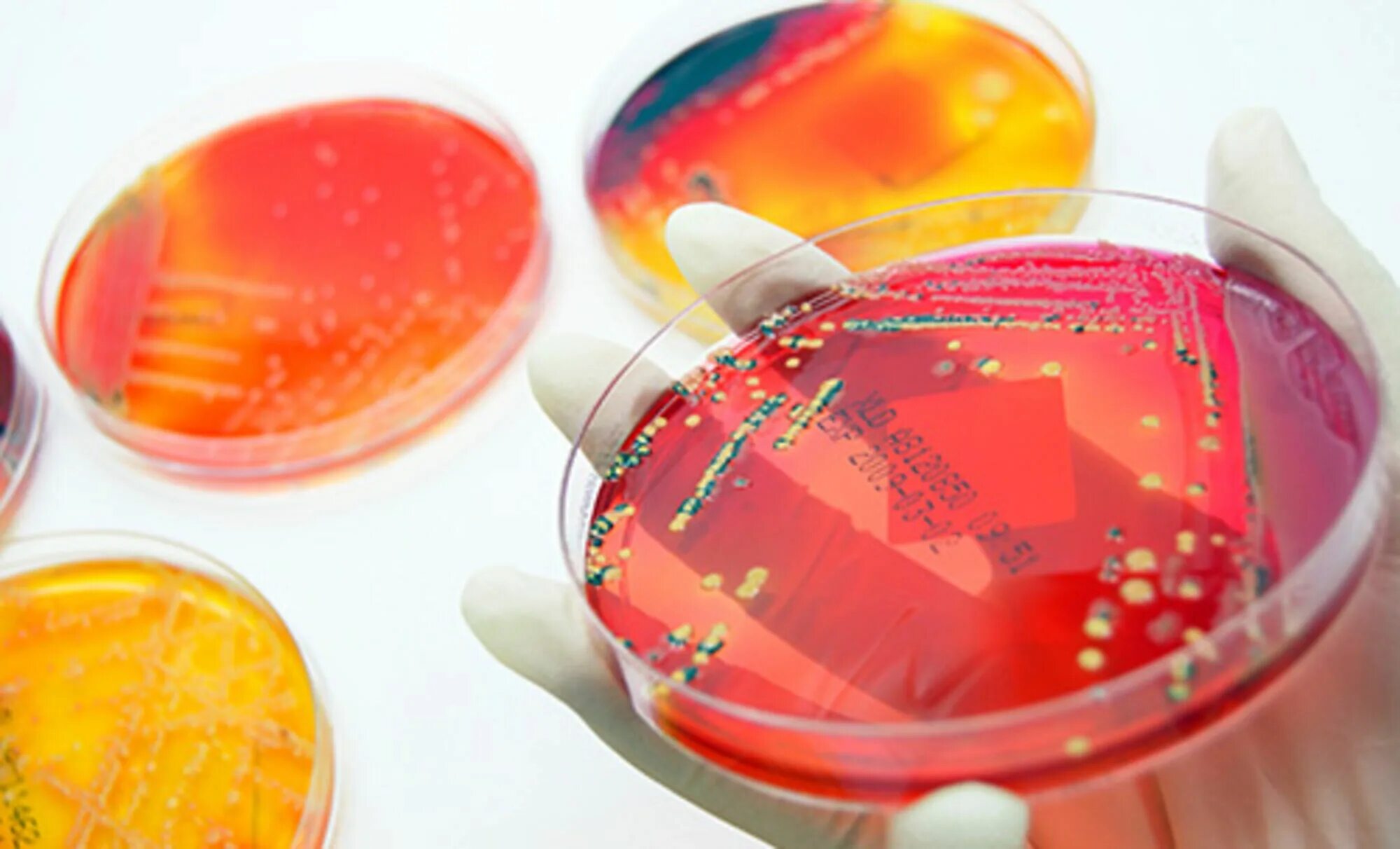 Микробиология занимается. Микробиологический mrsa. красители в микробиологии. красные красители микробиология. бады эубиотики.