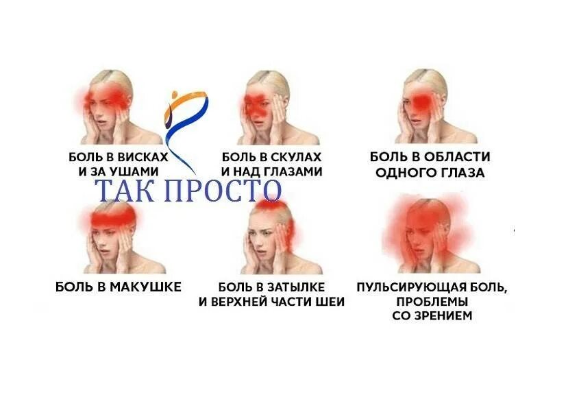 Сильно давит в висках. Головная боль. Области головной боли. Причины головной боли. Болит макушка головы.