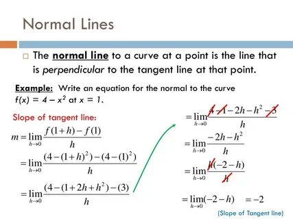 Normal line