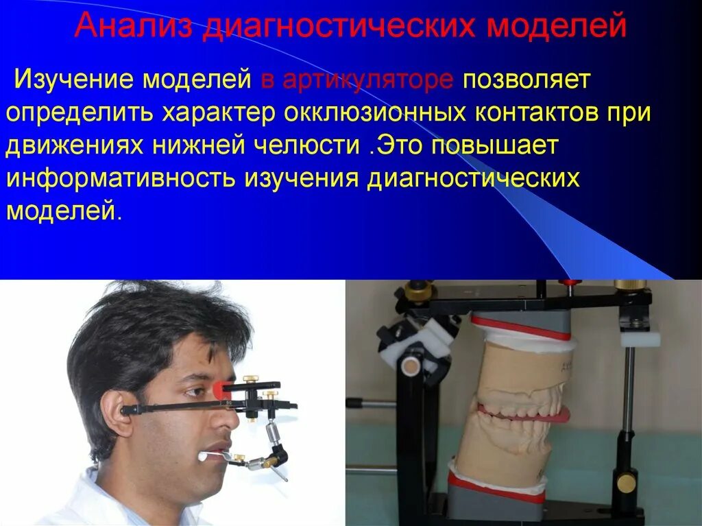 Анализ диагностических моделей в rp. Анализ диагностических моделей. Анализ диагностических моделей. Диагностические модели челюстей. Исследование на диагностических моделях челюстей.