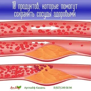 Бляшка 30