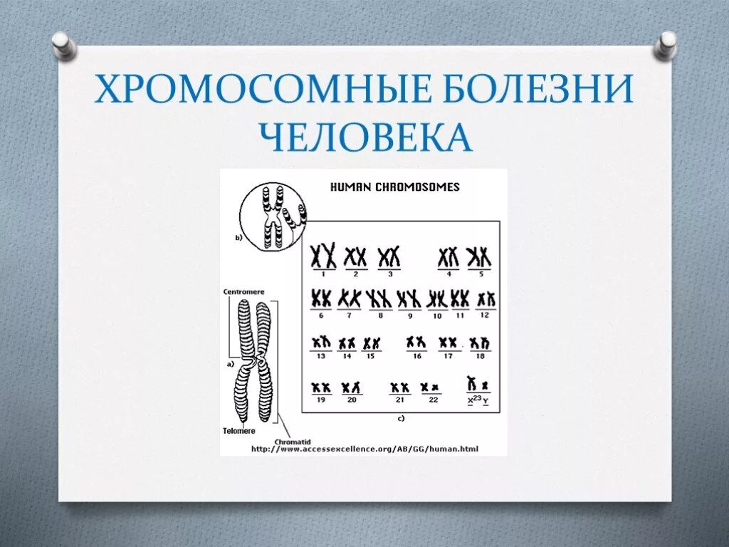 Хромосомныеболехни человека. Хромосомные заболевания человека. Заболевания по y хромосоме.