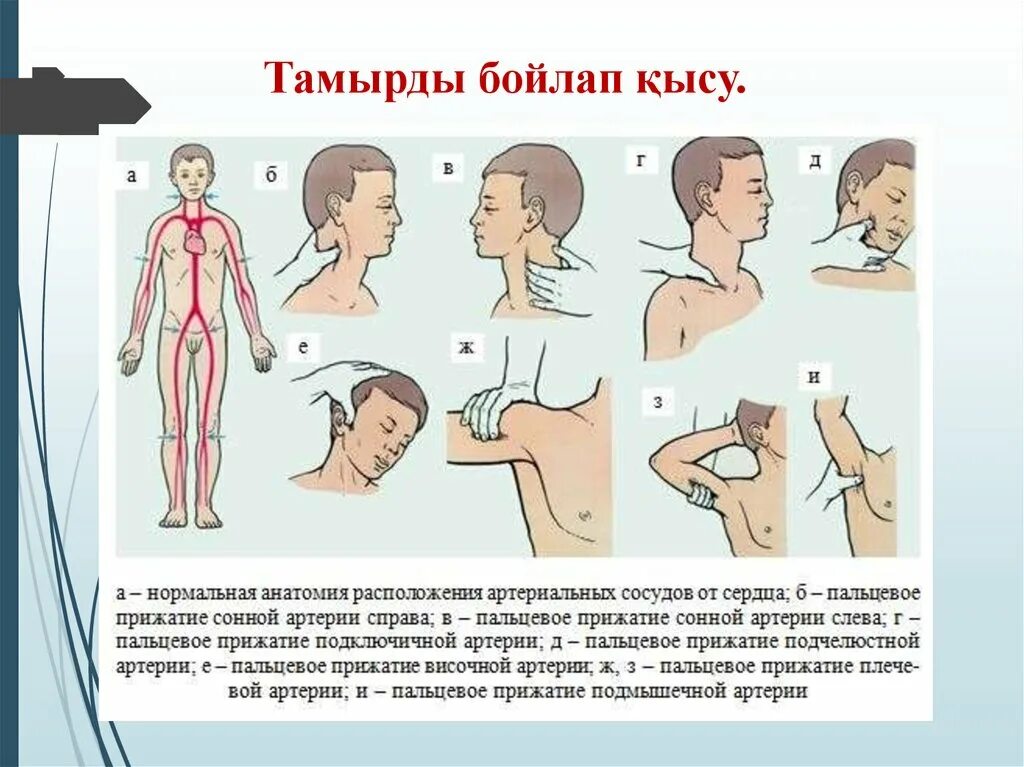 Способы остановки кровотечения пальцевое прижатие артерии. Метод пальцевого прижатия артерий. Места остановки кровотечения. Остановка кровотечения прижатием. Методы прижатия артерий при кровотечении.