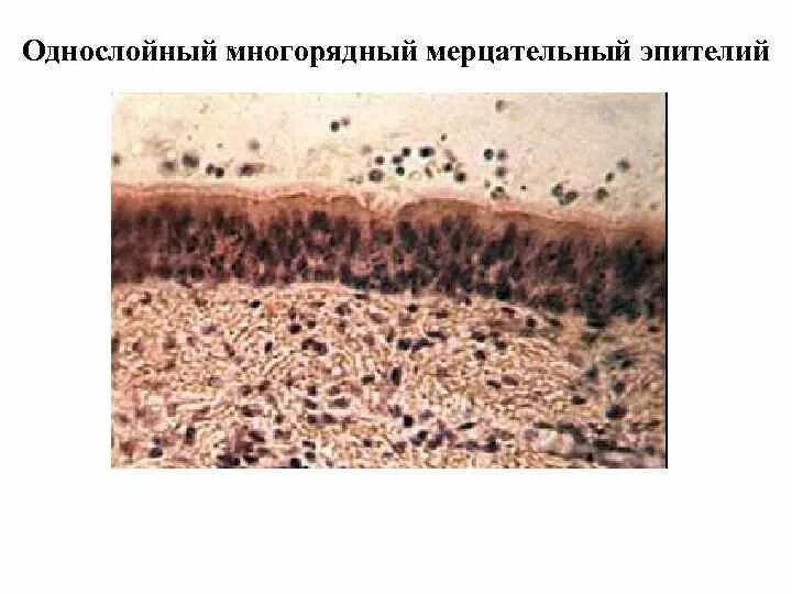 Однослойный плоский мерцательный эпителий. Ворсинки мерцательного эпителия. Однослойный многорядный мерцательный эпителий выстилает. Однослойный многорядный мерцательный эпителий. Медицинский препарат проникает в клетки мерцательного