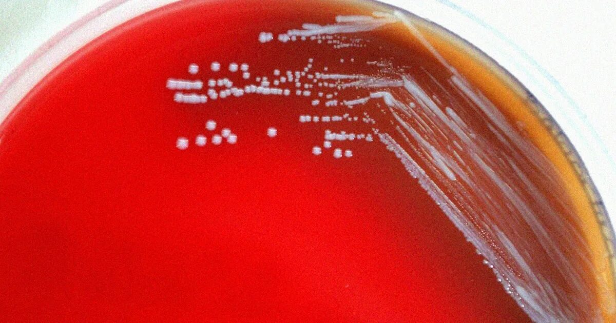Brucella spp. Бруцелла абортус. brucella melitensis микробиология. бруцеллы на питательных средах. brucella abortus микробиология.