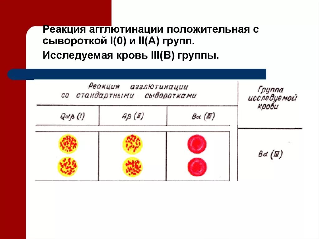 Первая группа 00. Реакция агглютинации резус фактор. Реакция агглютинации произошла с сывороткой 1 и 2 группы. Сыворотка агглютинации 1 и 3 группы крови. Реакция агглютинации группы крови.